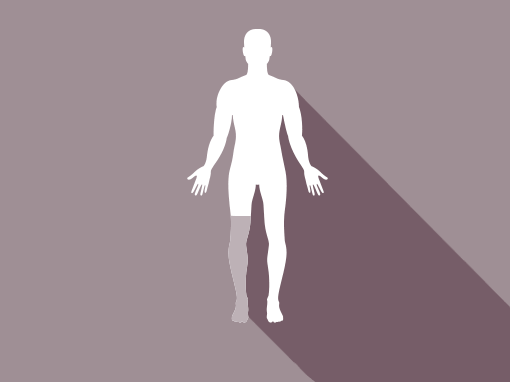Lårbensprotese / TF (Transfemoral amputation))