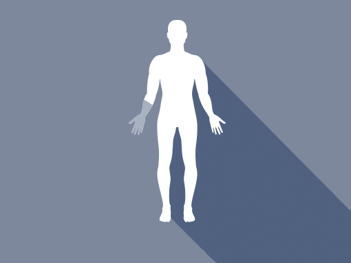 Underarmsprotese / TR (Transradial amputation)