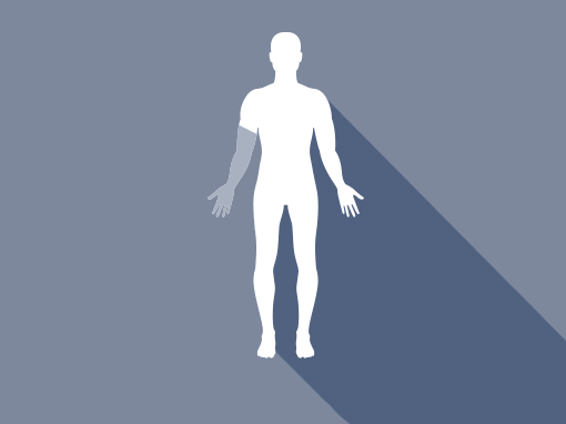 Overarmsprotese / TH (Transhumeral amputation)