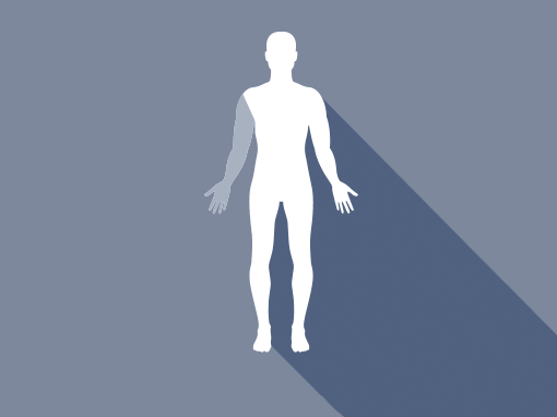 Skulderprotese / SD (Shoulder disarticulation)