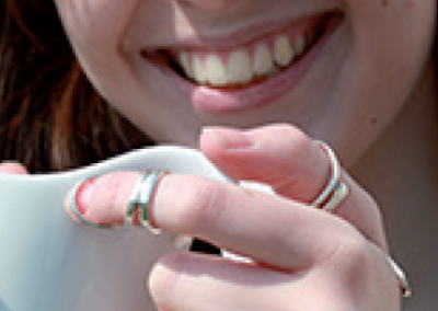 Silversplints – fingerortoser i sølv