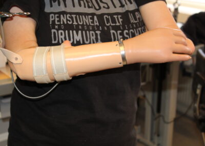 Kropsdrevet/mekanisk armprotese
