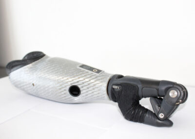 Myoelektrisk armprotese