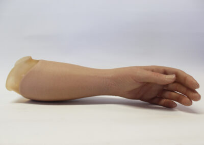 Kosmetisk/æstetisk armprotese