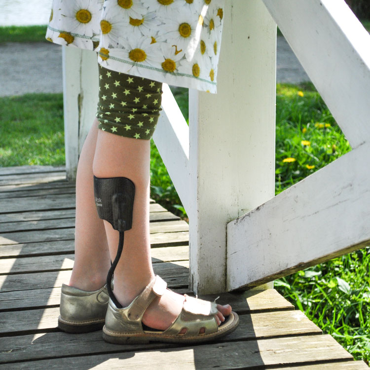 benprotese, bandagist og kunde