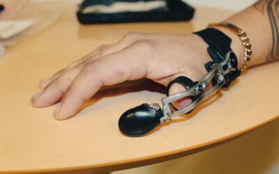 Frederik får finmotorikken tilbage med MCP Driver