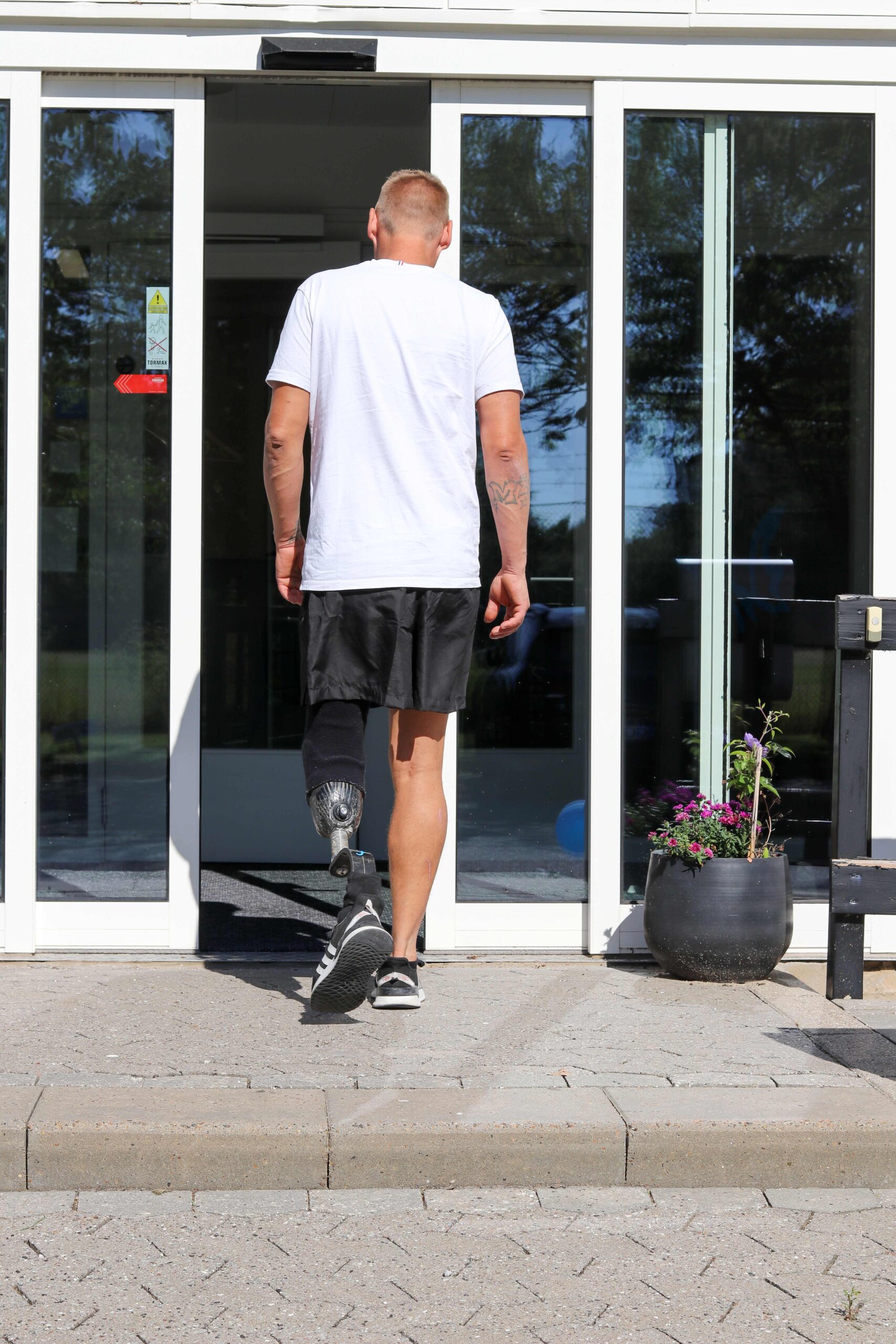 Benprotesebruger_Jimmy_2