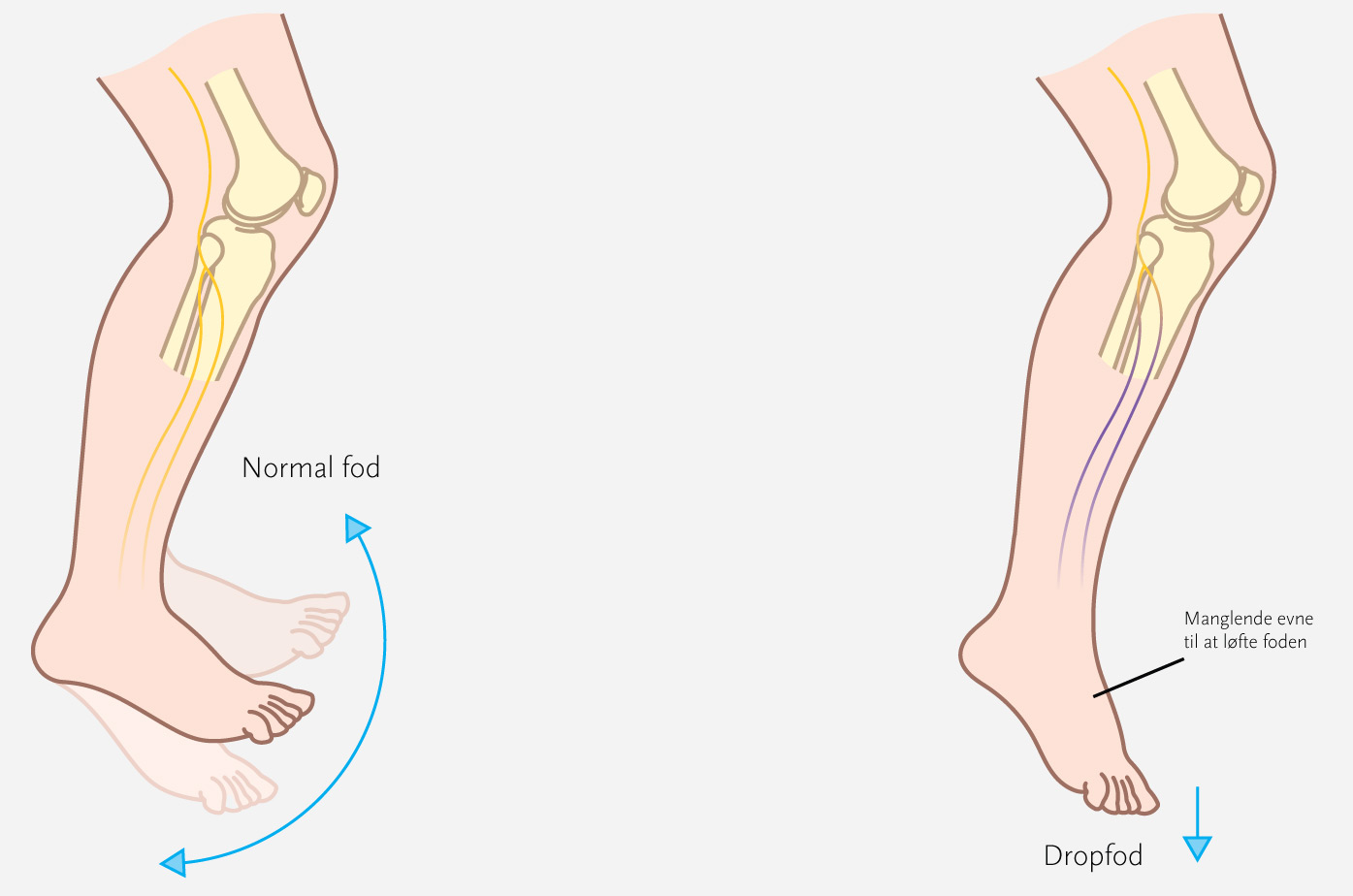 Normal-fod_vs_dropfod_generel